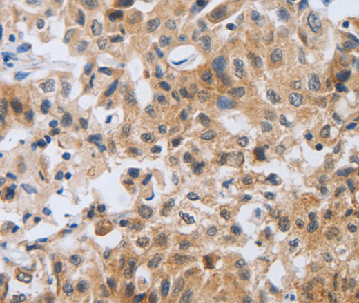 NEB Polyclonal Antibody (E-AB-12799)