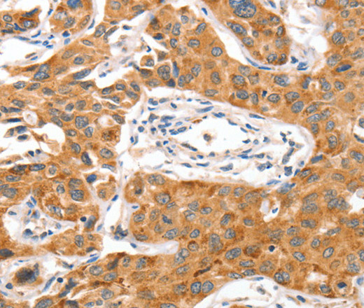 NUAK1 Polyclonal Antibody (E-AB-16173)