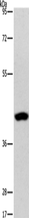PHYKPL Polyclonal Antibody (E-AB-14525)