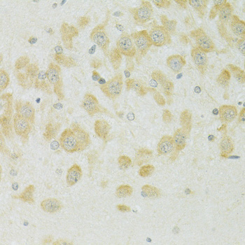 SLC37A4 Polyclonal Antibody (E-AB-65038)