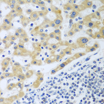 SHBG Polyclonal Antibody (E-AB-61712)