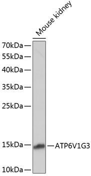 ATP6V1G3 Polyclonal Antibody (E-AB-65007)