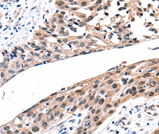 Connexin-26 Polyclonal Antibody (E-AB-12460)