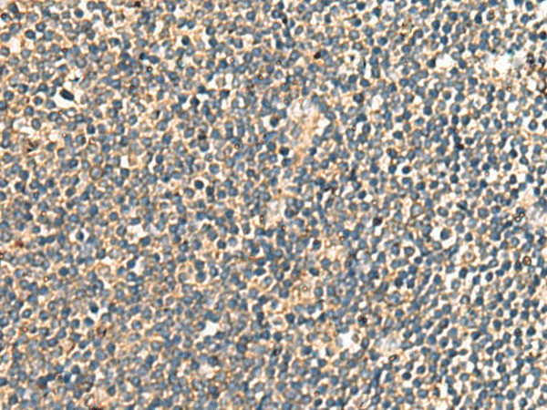 PRKRA Polyclonal Antibody (E-AB-53141)