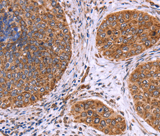 CLUAP1 Polyclonal Antibody (E-AB-11090)