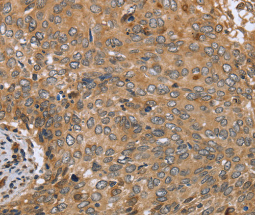 CLEC16A Polyclonal Antibody (E-AB-16647)