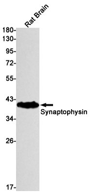 Recombinant Synaptophysin Monoclonal Antibody (E-AB-81610)