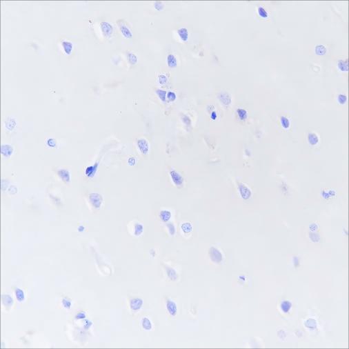Recombinant DPEP1 Monoclonal Antibody (AN301507L)