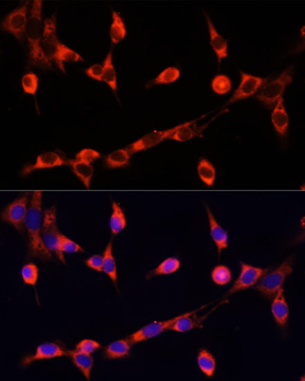 CHAT Polyclonal Antibody (E-AB-66032)