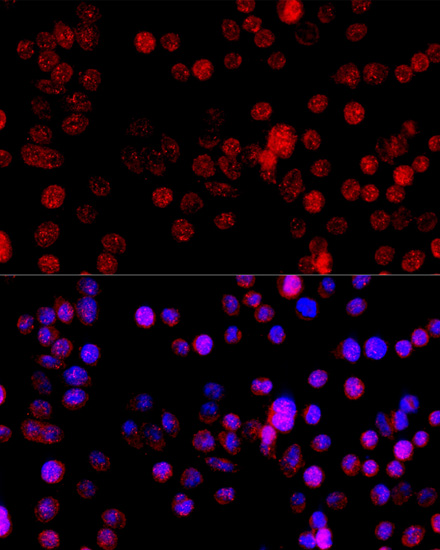 CYP1B1 Polyclonal Antibody (E-AB-66179)