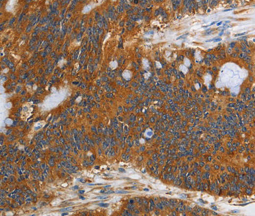 PI 3 Kinase Class 3 Polyclonal Antibody (E-AB-16184)