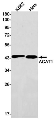 Recombinant ACAT1 Monoclonal Antibody (E-AB-81523)