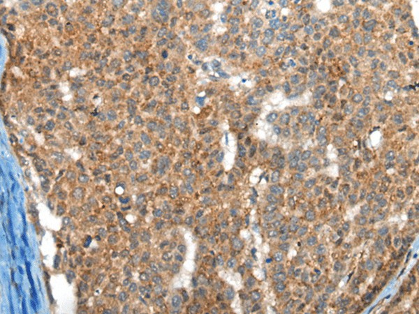 FTL Polyclonal Antibody (E-AB-52135)
