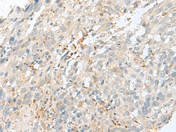 TPMT Polyclonal Antibody (E-AB-52714)