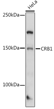 CRB1 Polyclonal Antibody (E-AB-90235)