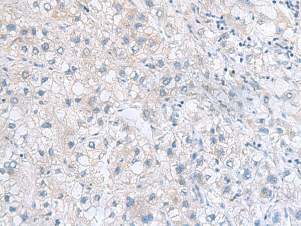 MYDGF Polyclonal Antibody (E-AB-19144)