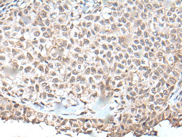 UBN1 Polyclonal Antibody (E-AB-19597)