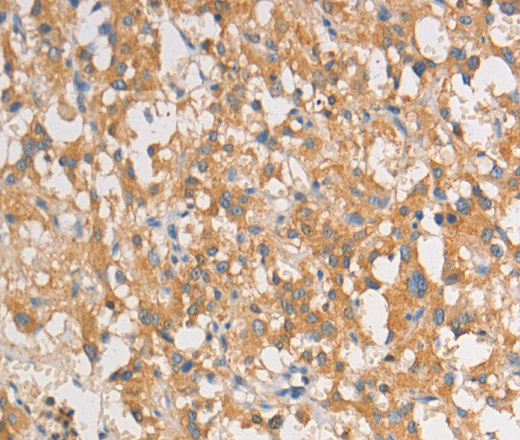 ART3 Polyclonal Antibody (E-AB-10857)