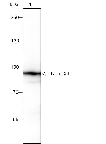 Recombinant Factor XIIIa Monoclonal Antibody (AN301519L)