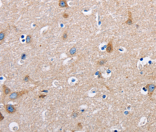 FN1 Polyclonal Antibody (E-AB-10003)