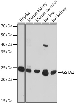 GSTA1 Polyclonal Antibody (E-AB-67330)
