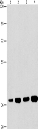 SERPINA9 Polyclonal Antibody (E-AB-16214)