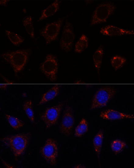 TBRG4 Polyclonal Antibody (E-AB-66560)