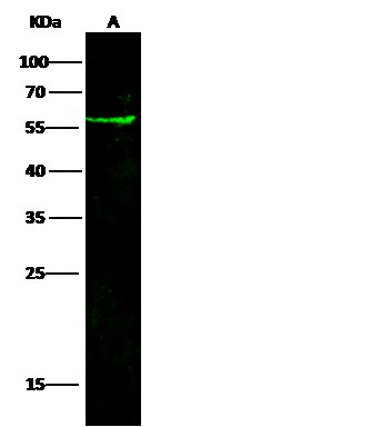 Recombinant Coagulation Factor III/Tissue Factor/CD142 Monoclonal Antibody (AN300515P)
