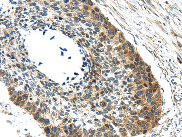 GRIN2A Polyclonal Antibody (E-AB-17358)