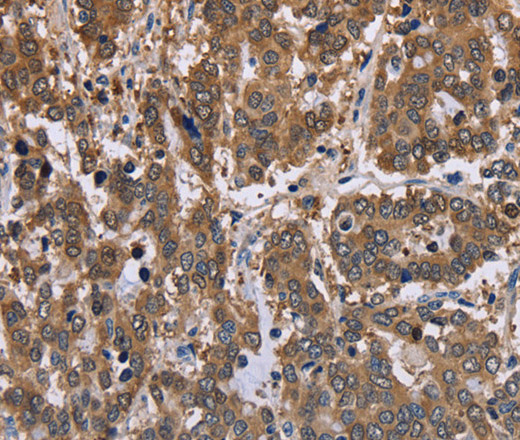 FBP2 Polyclonal Antibody (E-AB-11225)