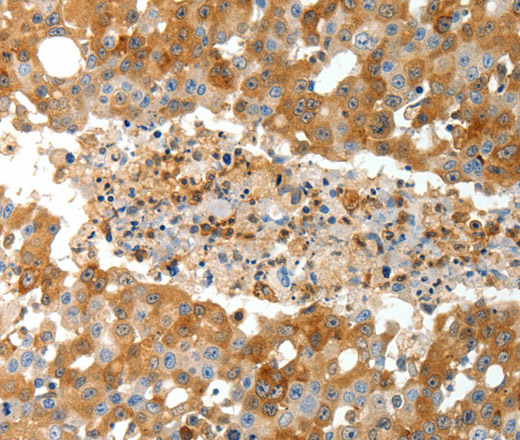 TEP1 Polyclonal Antibody (E-AB-16092)