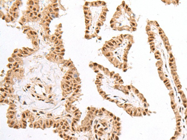 KDM2A Polyclonal Antibody (E-AB-19855)