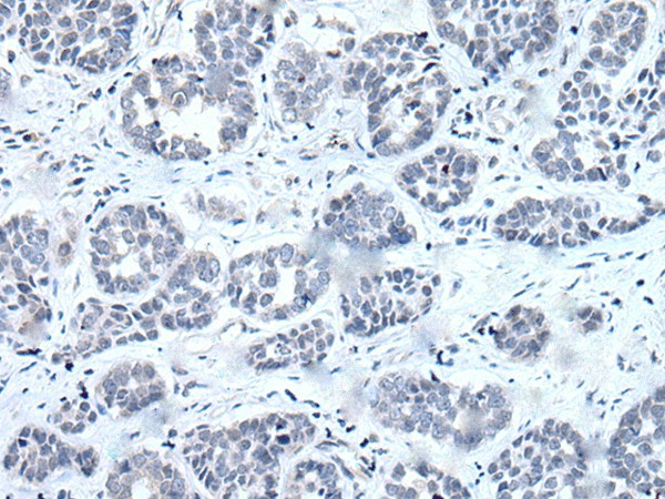 RARG Polyclonal Antibody (E-AB-53324)