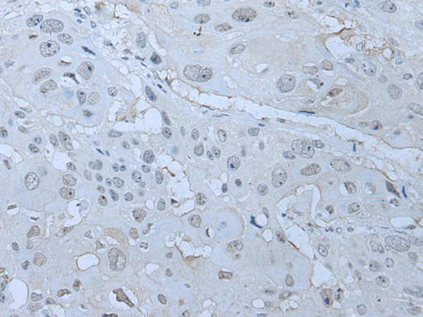 HUWE1 Polyclonal Antibody (E-AB-19540)