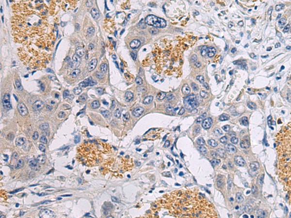 CHST3 Polyclonal Antibody (E-AB-19704)