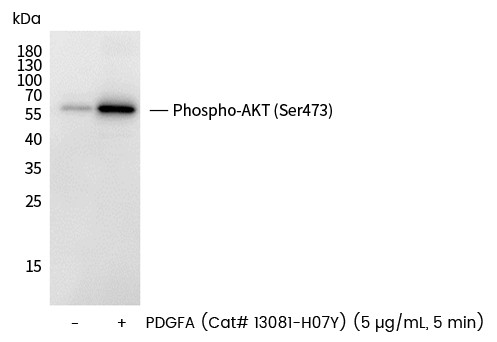 Recombinant Phospho-AKT (Ser473) Monoclonal Antibody (AN300376P)