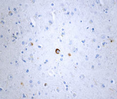 Purified anti-Tau, x-421 Antibody (Previously Covance catalog# SIG-39410) (806304)