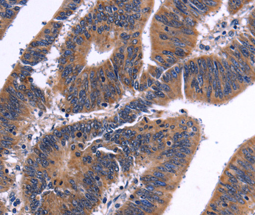 NFATC3 Polyclonal Antibody (E-AB-10486)