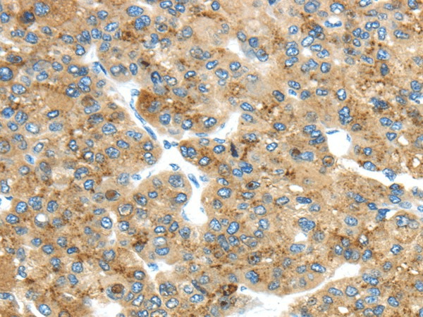 TMED4 Polyclonal Antibody (E-AB-17108)