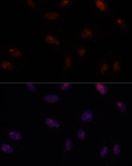 SF3B1 Polyclonal Antibody (E-AB-66583)