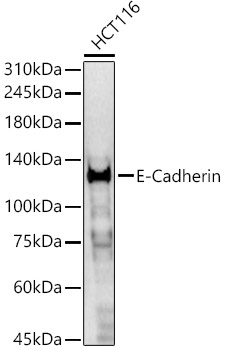 E-Cadherin Polyclonal Antibody (E-AB-93060)