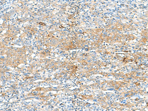 HLA-DRB3 Polyclonal Antibody (E-AB-18084)
