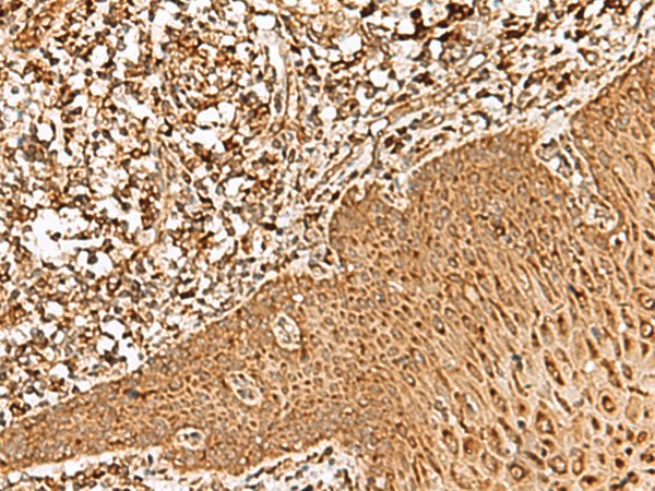 FAM200A Polyclonal Antibody (E-AB-17941)