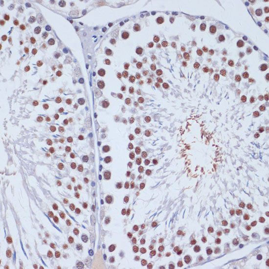 DNMT3L Polyclonal Antibody (E-AB-67432)