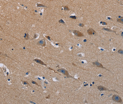 PLXND1 Polyclonal Antibody (E-AB-13524)