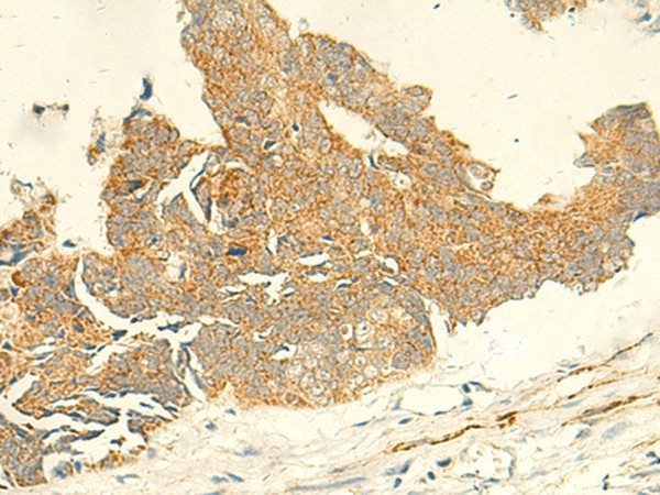TMEM9 Polyclonal Antibody (E-AB-52834)
