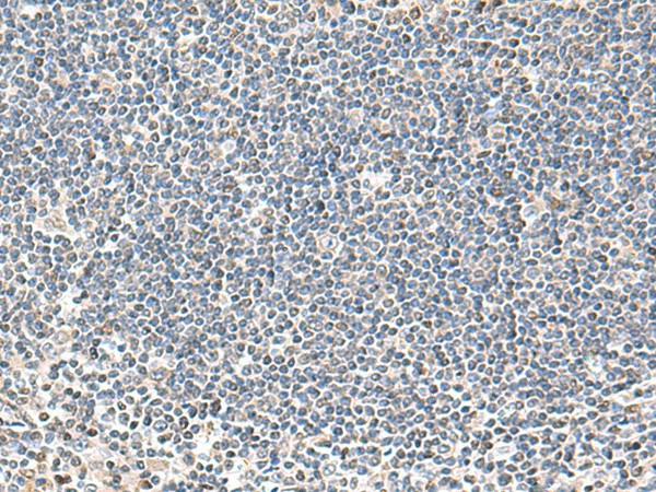 IFNA2 Polyclonal Antibody (E-AB-52031)