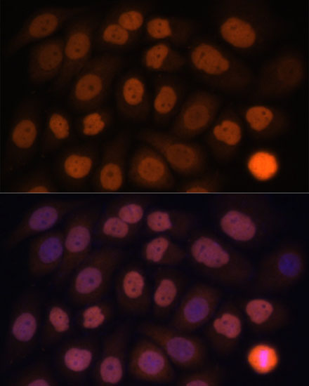 KLF6 Polyclonal Antibody (E-AB-65726)