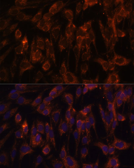 TLR3 Polyclonal Antibody (E-AB-65840)