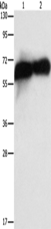 Placental Alkaline Phosphatase Polyclonal Antibody (E-AB-10977)